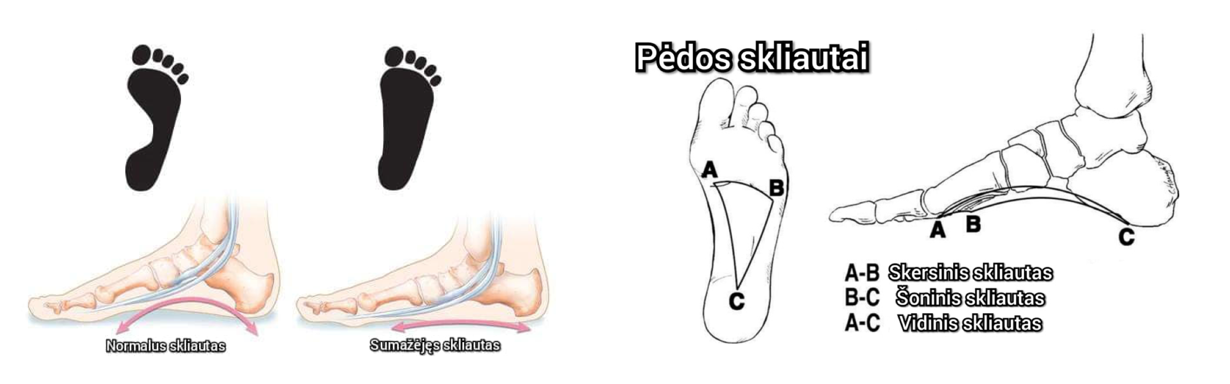 Ortopediniai profilaktiniai batai mergaitėms ir batai berniukams